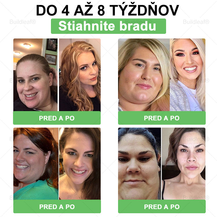 🎁 Zostáva už len 5 krabičiek! Ponúkame vám dodatočnú zľavu 50 %! Dostaňte sa do formy a buďte zdraví. Schudnite teraz – ďalšiu šancu už tento rok mať nebudete!