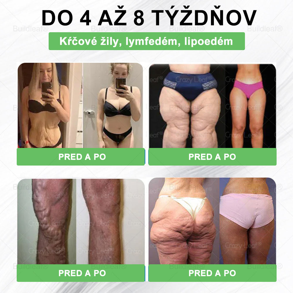 🎁 Zostáva už len 5 krabičiek! Ponúkame vám dodatočnú zľavu 50 %! Dostaňte sa do formy a buďte zdraví. Schudnite teraz – ďalšiu šancu už tento rok mať nebudete!