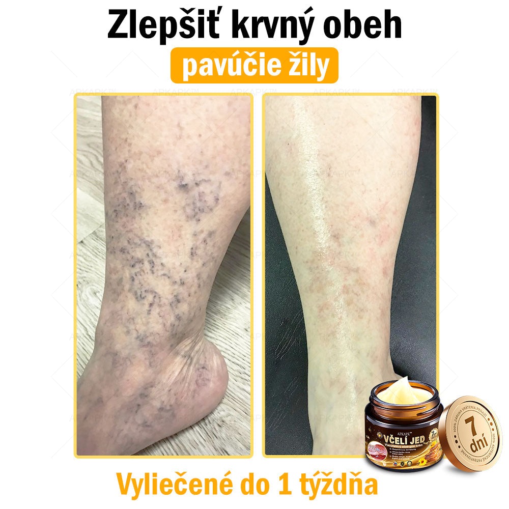 𝐀𝐏𝐊𝐀𝐏𝐊™ 𝐕č𝐞𝐥í 𝐉𝐞𝐝 𝐊𝐫é𝐦 𝐍𝐚 𝐑𝐞𝐠𝐞𝐧𝐞𝐫á𝐜𝐢𝐮 𝐏𝐥𝐞𝐭𝐢