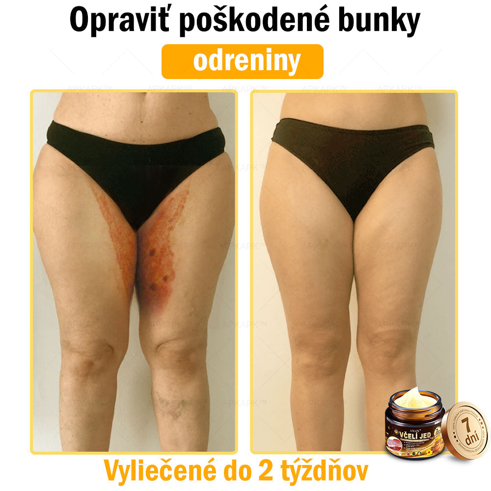 𝐀𝐏𝐊𝐀𝐏𝐊™ 𝐕č𝐞𝐥í 𝐉𝐞𝐝 𝐊𝐫é𝐦 𝐍𝐚 𝐑𝐞𝐠𝐞𝐧𝐞𝐫á𝐜𝐢𝐮 𝐏𝐥𝐞𝐭𝐢 🧑‍⚕️𝐎š𝐞𝐭𝐫𝐞𝐧𝐢𝐞 𝐤𝐨ž𝐧ý𝐜𝐡 𝐩𝐫𝐨𝐛𝐥é𝐦𝐨𝐯 𝐳𝐚𝐡ŕň𝐚: 𝐯𝐞𝐤𝐨𝐯é š𝐤𝐯𝐫𝐧𝐲, 𝐣𝐚𝐳𝐯𝐲, 𝐛𝐫𝐚𝐝𝐚𝐯𝐢𝐜𝐞, 𝐤𝐨ž𝐧é 𝐯ý𝐫𝐚𝐬𝐭𝐤𝐲, 𝐟𝐮𝐫𝐮𝐧𝐤𝐥𝐲, 𝐚𝐤𝐧é, 𝐞𝐤𝐳é𝐦𝐲, 𝐩𝐬𝐨𝐫𝐢á𝐳𝐮, 𝐚𝐤𝐧é 𝐢𝐧𝐯𝐞𝐫𝐬𝐚, 𝐯𝐫á𝐬𝐤𝐲, 𝐬𝐭𝐚𝐫𝐧𝐮𝐭𝐢𝐞 𝐩𝐥𝐞𝐭𝐢 𝐚 ď𝐚𝐥š𝐢𝐞.🔥🔥🔥