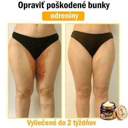 𝐀𝐏𝐊𝐀𝐏𝐊™ 𝐕č𝐞𝐥í 𝐉𝐞𝐝 𝐊𝐫é𝐦 𝐍𝐚 𝐑𝐞𝐠𝐞𝐧𝐞𝐫á𝐜𝐢𝐮 𝐏𝐥𝐞𝐭𝐢 🧑‍⚕️𝐎š𝐞𝐭𝐫𝐞𝐧𝐢𝐞 𝐤𝐨ž𝐧ý𝐜𝐡 𝐩𝐫𝐨𝐛𝐥é𝐦𝐨𝐯 𝐳𝐚𝐡ŕň𝐚: 𝐯𝐞𝐤𝐨𝐯é š𝐤𝐯𝐫𝐧𝐲, 𝐣𝐚𝐳𝐯𝐲, 𝐛𝐫𝐚𝐝𝐚𝐯𝐢𝐜𝐞, 𝐤𝐨ž𝐧é 𝐯ý𝐫𝐚𝐬𝐭𝐤𝐲, 𝐟𝐮𝐫𝐮𝐧𝐤𝐥𝐲, 𝐚𝐤𝐧é, 𝐞𝐤𝐳é𝐦𝐲, 𝐩𝐬𝐨𝐫𝐢á𝐳𝐮, 𝐚𝐤𝐧é 𝐢𝐧𝐯𝐞𝐫𝐬𝐚, 𝐯𝐫á𝐬𝐤𝐲, 𝐬𝐭𝐚𝐫𝐧𝐮𝐭𝐢𝐞 𝐩𝐥𝐞𝐭𝐢 𝐚 ď𝐚𝐥š𝐢𝐞.🔥🔥🔥