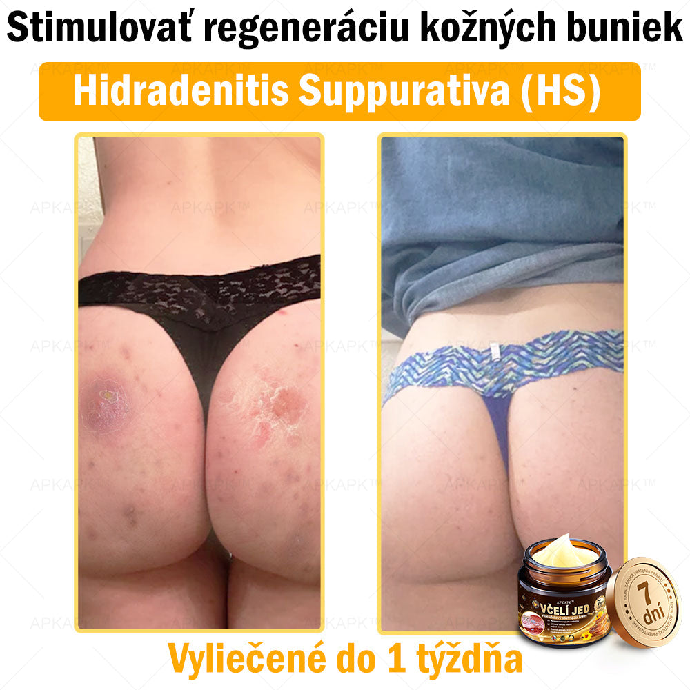 𝐀𝐏𝐊𝐀𝐏𝐊™ 𝐕č𝐞𝐥í 𝐉𝐞𝐝 𝐊𝐫é𝐦 𝐍𝐚 𝐑𝐞𝐠𝐞𝐧𝐞𝐫á𝐜𝐢𝐮 𝐏𝐥𝐞𝐭𝐢 🧑‍⚕️𝐎š𝐞𝐭𝐫𝐞𝐧𝐢𝐞 𝐤𝐨ž𝐧ý𝐜𝐡 𝐩𝐫𝐨𝐛𝐥é𝐦𝐨𝐯 𝐳𝐚𝐡ŕň𝐚: 𝐯𝐞𝐤𝐨𝐯é š𝐤𝐯𝐫𝐧𝐲, 𝐣𝐚𝐳𝐯𝐲, 𝐛𝐫𝐚𝐝𝐚𝐯𝐢𝐜𝐞, 𝐤𝐨ž𝐧é 𝐯ý𝐫𝐚𝐬𝐭𝐤𝐲, 𝐟𝐮𝐫𝐮𝐧𝐤𝐥𝐲, 𝐚𝐤𝐧é, 𝐞𝐤𝐳é𝐦𝐲, 𝐩𝐬𝐨𝐫𝐢á𝐳𝐮, 𝐚𝐤𝐧é 𝐢𝐧𝐯𝐞𝐫𝐬𝐚, 𝐯𝐫á𝐬𝐤𝐲, 𝐬𝐭𝐚𝐫𝐧𝐮𝐭𝐢𝐞 𝐩𝐥𝐞𝐭𝐢 𝐚 ď𝐚𝐥š𝐢𝐞.🔥🔥🔥