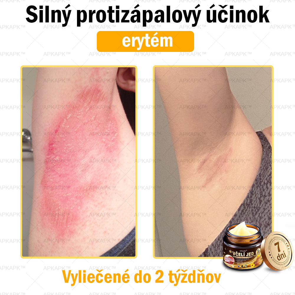 𝐀𝐏𝐊𝐀𝐏𝐊™ 𝐕č𝐞𝐥í 𝐉𝐞𝐝 𝐊𝐫é𝐦 𝐍𝐚 𝐑𝐞𝐠𝐞𝐧𝐞𝐫á𝐜𝐢𝐮 𝐏𝐥𝐞𝐭𝐢 🧑‍⚕️𝐎š𝐞𝐭𝐫𝐞𝐧𝐢𝐞 𝐤𝐨ž𝐧ý𝐜𝐡 𝐩𝐫𝐨𝐛𝐥é𝐦𝐨𝐯 𝐳𝐚𝐡ŕň𝐚: 𝐯𝐞𝐤𝐨𝐯é š𝐤𝐯𝐫𝐧𝐲, 𝐣𝐚𝐳𝐯𝐲, 𝐛𝐫𝐚𝐝𝐚𝐯𝐢𝐜𝐞, 𝐤𝐨ž𝐧é 𝐯ý𝐫𝐚𝐬𝐭𝐤𝐲, 𝐟𝐮𝐫𝐮𝐧𝐤𝐥𝐲, 𝐚𝐤𝐧é, 𝐞𝐤𝐳é𝐦𝐲, 𝐩𝐬𝐨𝐫𝐢á𝐳𝐮, 𝐚𝐤𝐧é 𝐢𝐧𝐯𝐞𝐫𝐬𝐚, 𝐯𝐫á𝐬𝐤𝐲, 𝐬𝐭𝐚𝐫𝐧𝐮𝐭𝐢𝐞 𝐩𝐥𝐞𝐭𝐢 𝐚 ď𝐚𝐥š𝐢𝐞.🔥🔥🔥