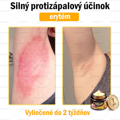 𝐀𝐏𝐊𝐀𝐏𝐊™ 𝐕č𝐞𝐥í 𝐉𝐞𝐝 𝐊𝐫é𝐦 𝐍𝐚 𝐑𝐞𝐠𝐞𝐧𝐞𝐫á𝐜𝐢𝐮 𝐏𝐥𝐞𝐭𝐢 🧑‍⚕️𝐎š𝐞𝐭𝐫𝐞𝐧𝐢𝐞 𝐤𝐨ž𝐧ý𝐜𝐡 𝐩𝐫𝐨𝐛𝐥é𝐦𝐨𝐯 𝐳𝐚𝐡ŕň𝐚: 𝐯𝐞𝐤𝐨𝐯é š𝐤𝐯𝐫𝐧𝐲, 𝐣𝐚𝐳𝐯𝐲, 𝐛𝐫𝐚𝐝𝐚𝐯𝐢𝐜𝐞, 𝐤𝐨ž𝐧é 𝐯ý𝐫𝐚𝐬𝐭𝐤𝐲, 𝐟𝐮𝐫𝐮𝐧𝐤𝐥𝐲, 𝐚𝐤𝐧é, 𝐞𝐤𝐳é𝐦𝐲, 𝐩𝐬𝐨𝐫𝐢á𝐳𝐮, 𝐚𝐤𝐧é 𝐢𝐧𝐯𝐞𝐫𝐬𝐚, 𝐯𝐫á𝐬𝐤𝐲, 𝐬𝐭𝐚𝐫𝐧𝐮𝐭𝐢𝐞 𝐩𝐥𝐞𝐭𝐢 𝐚 ď𝐚𝐥š𝐢𝐞.🔥🔥🔥
