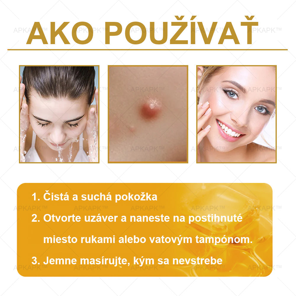 𝐀𝐏𝐊𝐀𝐏𝐊™ 𝐕č𝐞𝐥í 𝐉𝐞𝐝 𝐊𝐫é𝐦 𝐍𝐚 𝐑𝐞𝐠𝐞𝐧𝐞𝐫á𝐜𝐢𝐮 𝐏𝐥𝐞𝐭𝐢 🧑‍⚕️𝐎š𝐞𝐭𝐫𝐞𝐧𝐢𝐞 𝐤𝐨ž𝐧ý𝐜𝐡 𝐩𝐫𝐨𝐛𝐥é𝐦𝐨𝐯 𝐳𝐚𝐡ŕň𝐚: 𝐯𝐞𝐤𝐨𝐯é š𝐤𝐯𝐫𝐧𝐲, 𝐣𝐚𝐳𝐯𝐲, 𝐛𝐫𝐚𝐝𝐚𝐯𝐢𝐜𝐞, 𝐤𝐨ž𝐧é 𝐯ý𝐫𝐚𝐬𝐭𝐤𝐲, 𝐟𝐮𝐫𝐮𝐧𝐤𝐥𝐲, 𝐚𝐤𝐧é, 𝐞𝐤𝐳é𝐦𝐲, 𝐩𝐬𝐨𝐫𝐢á𝐳𝐮, 𝐚𝐤𝐧é 𝐢𝐧𝐯𝐞𝐫𝐬𝐚, 𝐯𝐫á𝐬𝐤𝐲, 𝐬𝐭𝐚𝐫𝐧𝐮𝐭𝐢𝐞 𝐩𝐥𝐞𝐭𝐢 𝐚 ď𝐚𝐥š𝐢𝐞.🔥🔥🔥