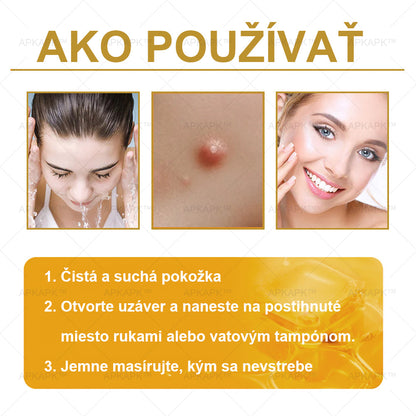 𝐀𝐏𝐊𝐀𝐏𝐊™ 𝐕č𝐞𝐥í 𝐉𝐞𝐝 𝐊𝐫é𝐦 𝐍𝐚 𝐑𝐞𝐠𝐞𝐧𝐞𝐫á𝐜𝐢𝐮 𝐏𝐥𝐞𝐭𝐢 🧑‍⚕️𝐎š𝐞𝐭𝐫𝐞𝐧𝐢𝐞 𝐤𝐨ž𝐧ý𝐜𝐡 𝐩𝐫𝐨𝐛𝐥é𝐦𝐨𝐯 𝐳𝐚𝐡ŕň𝐚: 𝐯𝐞𝐤𝐨𝐯é š𝐤𝐯𝐫𝐧𝐲, 𝐣𝐚𝐳𝐯𝐲, 𝐛𝐫𝐚𝐝𝐚𝐯𝐢𝐜𝐞, 𝐤𝐨ž𝐧é 𝐯ý𝐫𝐚𝐬𝐭𝐤𝐲, 𝐟𝐮𝐫𝐮𝐧𝐤𝐥𝐲, 𝐚𝐤𝐧é, 𝐞𝐤𝐳é𝐦𝐲, 𝐩𝐬𝐨𝐫𝐢á𝐳𝐮, 𝐚𝐤𝐧é 𝐢𝐧𝐯𝐞𝐫𝐬𝐚, 𝐯𝐫á𝐬𝐤𝐲, 𝐬𝐭𝐚𝐫𝐧𝐮𝐭𝐢𝐞 𝐩𝐥𝐞𝐭𝐢 𝐚 ď𝐚𝐥š𝐢𝐞.🔥🔥🔥