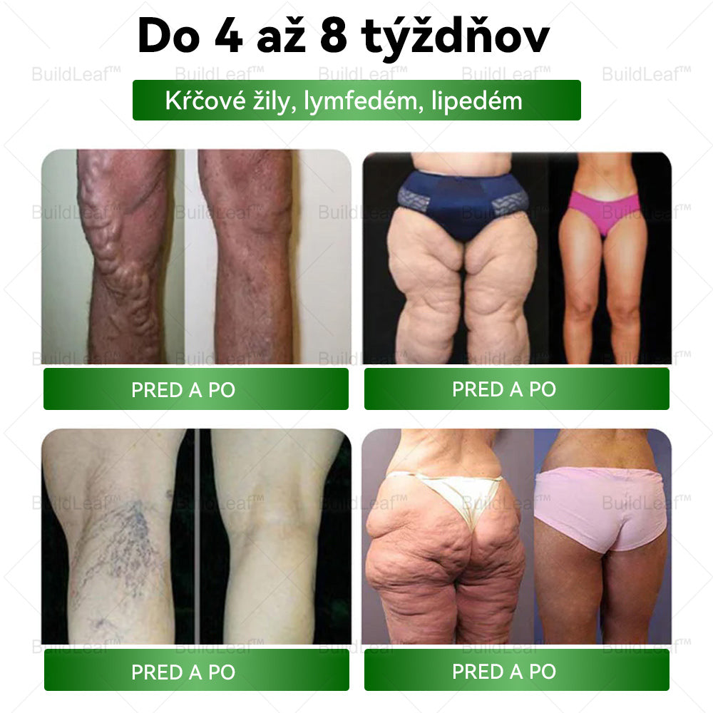 🎁 Zostáva už len 5 krabičiek! Ponúkame vám dodatočnú zľavu 50 %! Dostaňte sa do formy a buďte zdraví. Schudnite teraz – ďalšiu šancu už tento rok mať nebudete!