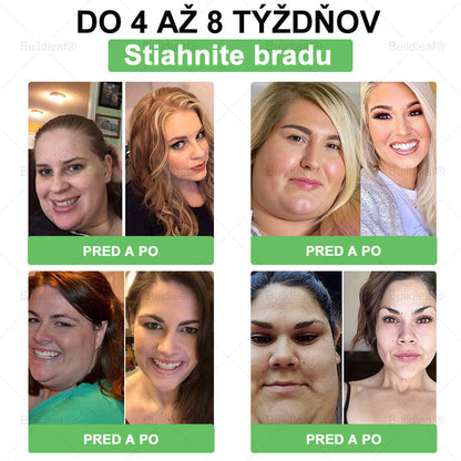 🎁 Zostáva už len 5 krabičiek! Ponúkame vám dodatočnú zľavu 50 %! Dostaňte sa do formy a buďte zdraví. Schudnite teraz – ďalšiu šancu už tento rok mať nebudete!