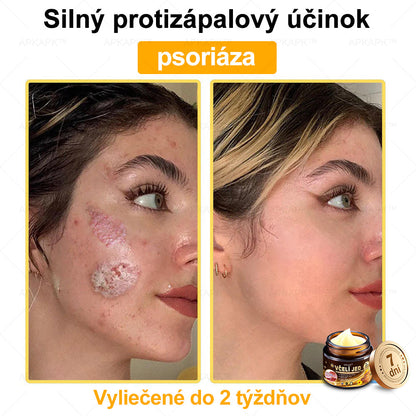 𝐀𝐏𝐊𝐀𝐏𝐊™ 𝐕č𝐞𝐥í 𝐉𝐞𝐝 𝐊𝐫é𝐦 𝐍𝐚 𝐑𝐞𝐠𝐞𝐧𝐞𝐫á𝐜𝐢𝐮 𝐏𝐥𝐞𝐭𝐢 🧑‍⚕️𝐎š𝐞𝐭𝐫𝐞𝐧𝐢𝐞 𝐤𝐨ž𝐧ý𝐜𝐡 𝐩𝐫𝐨𝐛𝐥é𝐦𝐨𝐯 𝐳𝐚𝐡ŕň𝐚: 𝐯𝐞𝐤𝐨𝐯é š𝐤𝐯𝐫𝐧𝐲, 𝐣𝐚𝐳𝐯𝐲, 𝐛𝐫𝐚𝐝𝐚𝐯𝐢𝐜𝐞, 𝐤𝐨ž𝐧é 𝐯ý𝐫𝐚𝐬𝐭𝐤𝐲, 𝐟𝐮𝐫𝐮𝐧𝐤𝐥𝐲, 𝐚𝐤𝐧é, 𝐞𝐤𝐳é𝐦𝐲, 𝐩𝐬𝐨𝐫𝐢á𝐳𝐮, 𝐚𝐤𝐧é 𝐢𝐧𝐯𝐞𝐫𝐬𝐚, 𝐯𝐫á𝐬𝐤𝐲, 𝐬𝐭𝐚𝐫𝐧𝐮𝐭𝐢𝐞 𝐩𝐥𝐞𝐭𝐢 𝐚 ď𝐚𝐥š𝐢𝐞.🔥🔥🔥
