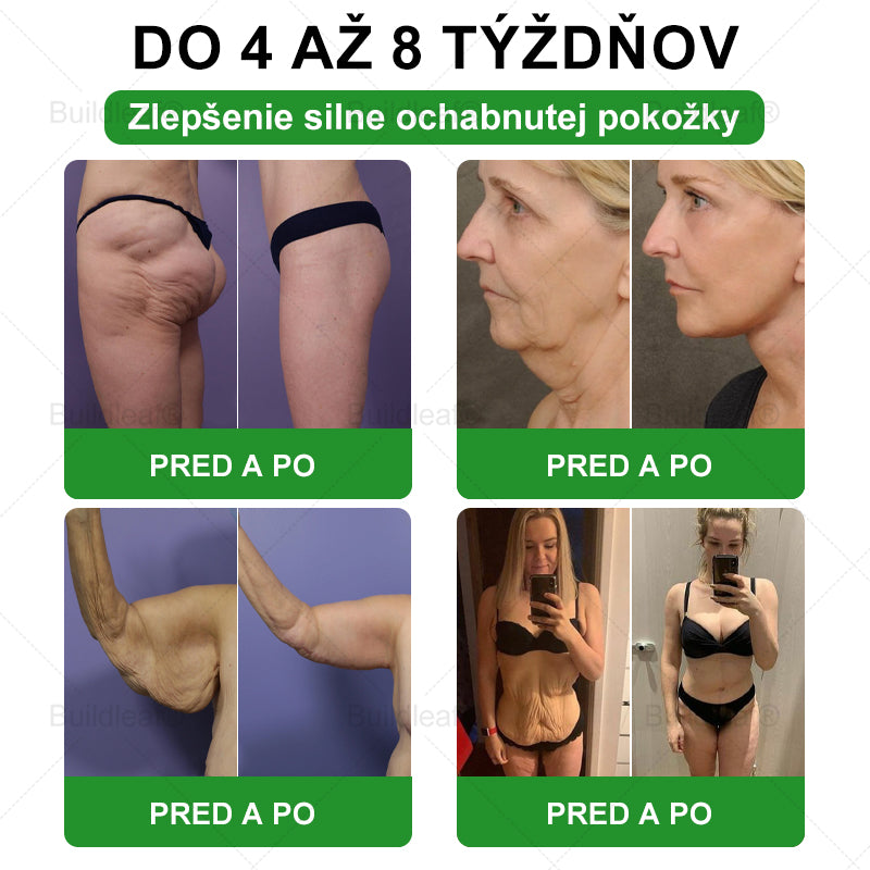 🎁 Zostáva už len 5 krabičiek! Ponúkame vám dodatočnú zľavu 50 %! Dostaňte sa do formy a buďte zdraví. Schudnite teraz – ďalšiu šancu už tento rok mať nebudete!