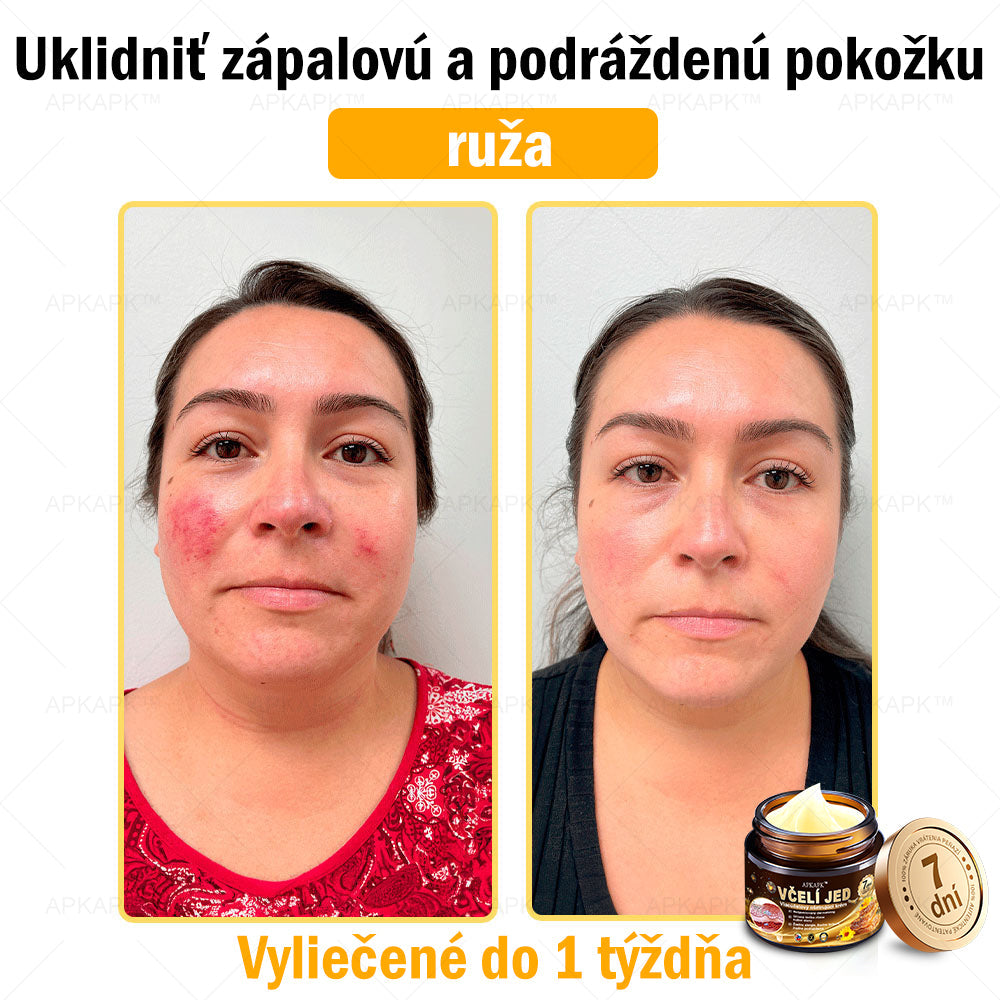 𝐀𝐏𝐊𝐀𝐏𝐊™ 𝐕č𝐞𝐥í 𝐉𝐞𝐝 𝐊𝐫é𝐦 𝐍𝐚 𝐑𝐞𝐠𝐞𝐧𝐞𝐫á𝐜𝐢𝐮 𝐏𝐥𝐞𝐭𝐢 🧑‍⚕️𝐎š𝐞𝐭𝐫𝐞𝐧𝐢𝐞 𝐤𝐨ž𝐧ý𝐜𝐡 𝐩𝐫𝐨𝐛𝐥é𝐦𝐨𝐯 𝐳𝐚𝐡ŕň𝐚: 𝐯𝐞𝐤𝐨𝐯é š𝐤𝐯𝐫𝐧𝐲, 𝐣𝐚𝐳𝐯𝐲, 𝐛𝐫𝐚𝐝𝐚𝐯𝐢𝐜𝐞, 𝐤𝐨ž𝐧é 𝐯ý𝐫𝐚𝐬𝐭𝐤𝐲, 𝐟𝐮𝐫𝐮𝐧𝐤𝐥𝐲, 𝐚𝐤𝐧é, 𝐞𝐤𝐳é𝐦𝐲, 𝐩𝐬𝐨𝐫𝐢á𝐳𝐮, 𝐚𝐤𝐧é 𝐢𝐧𝐯𝐞𝐫𝐬𝐚, 𝐯𝐫á𝐬𝐤𝐲, 𝐬𝐭𝐚𝐫𝐧𝐮𝐭𝐢𝐞 𝐩𝐥𝐞𝐭𝐢 𝐚 ď𝐚𝐥š𝐢𝐞.🔥🔥🔥