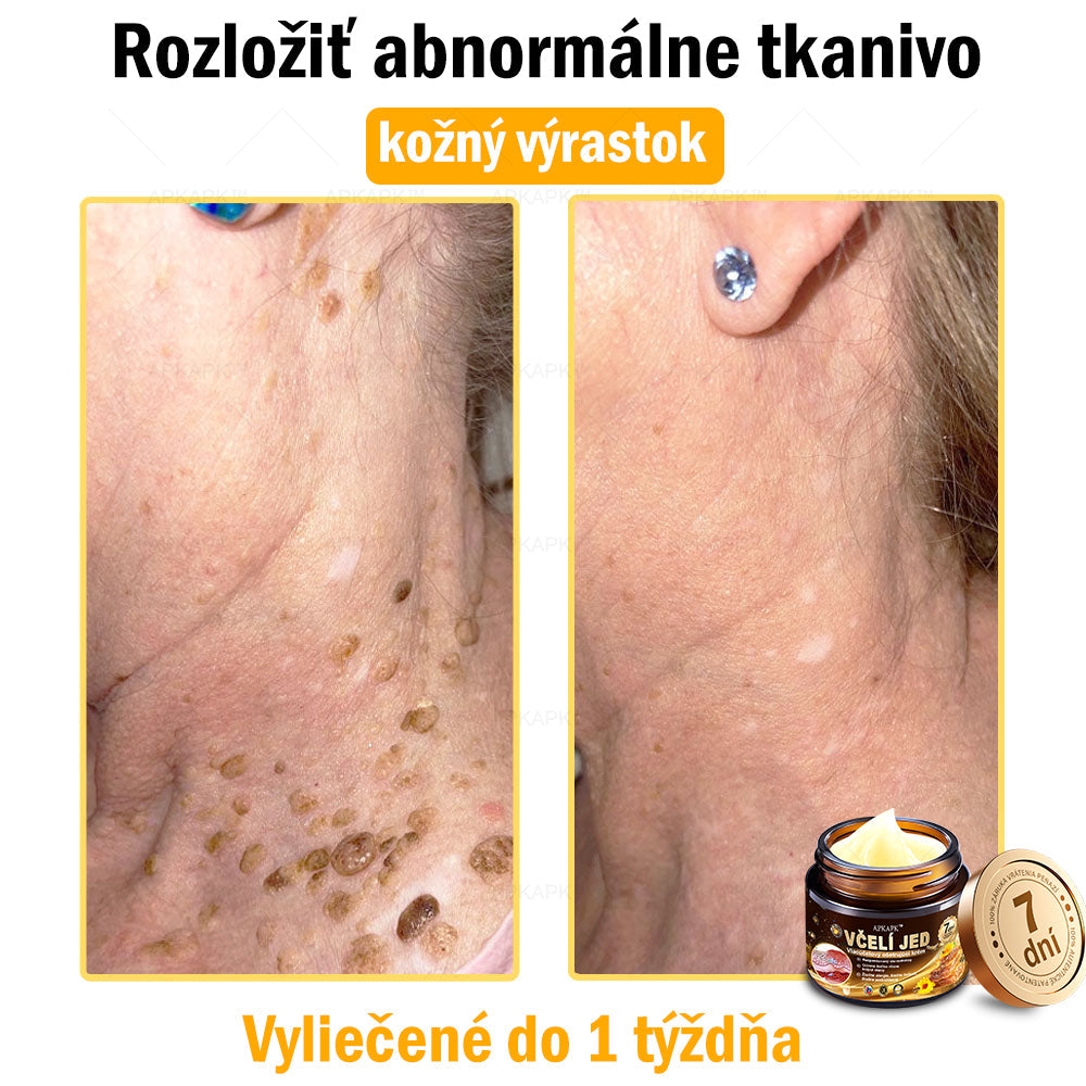 𝐀𝐏𝐊𝐀𝐏𝐊™ 𝐕č𝐞𝐥í 𝐉𝐞𝐝 𝐊𝐫é𝐦 𝐍𝐚 𝐑𝐞𝐠𝐞𝐧𝐞𝐫á𝐜𝐢𝐮 𝐏𝐥𝐞𝐭𝐢 🧑‍⚕️𝐎š𝐞𝐭𝐫𝐞𝐧𝐢𝐞 𝐤𝐨ž𝐧ý𝐜𝐡 𝐩𝐫𝐨𝐛𝐥é𝐦𝐨𝐯 𝐳𝐚𝐡ŕň𝐚: 𝐯𝐞𝐤𝐨𝐯é š𝐤𝐯𝐫𝐧𝐲, 𝐣𝐚𝐳𝐯𝐲, 𝐛𝐫𝐚𝐝𝐚𝐯𝐢𝐜𝐞, 𝐤𝐨ž𝐧é 𝐯ý𝐫𝐚𝐬𝐭𝐤𝐲, 𝐟𝐮𝐫𝐮𝐧𝐤𝐥𝐲, 𝐚𝐤𝐧é, 𝐞𝐤𝐳é𝐦𝐲, 𝐩𝐬𝐨𝐫𝐢á𝐳𝐮, 𝐚𝐤𝐧é 𝐢𝐧𝐯𝐞𝐫𝐬𝐚, 𝐯𝐫á𝐬𝐤𝐲, 𝐬𝐭𝐚𝐫𝐧𝐮𝐭𝐢𝐞 𝐩𝐥𝐞𝐭𝐢 𝐚 ď𝐚𝐥š𝐢𝐞.🔥🔥🔥