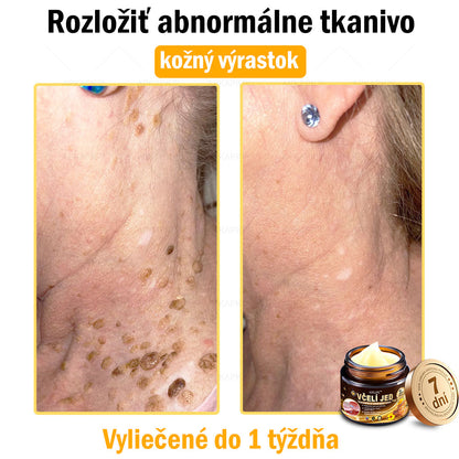 𝐀𝐏𝐊𝐀𝐏𝐊™ 𝐕č𝐞𝐥í 𝐉𝐞𝐝 𝐊𝐫é𝐦 𝐍𝐚 𝐑𝐞𝐠𝐞𝐧𝐞𝐫á𝐜𝐢𝐮 𝐏𝐥𝐞𝐭𝐢 🧑‍⚕️𝐎š𝐞𝐭𝐫𝐞𝐧𝐢𝐞 𝐤𝐨ž𝐧ý𝐜𝐡 𝐩𝐫𝐨𝐛𝐥é𝐦𝐨𝐯 𝐳𝐚𝐡ŕň𝐚: 𝐯𝐞𝐤𝐨𝐯é š𝐤𝐯𝐫𝐧𝐲, 𝐣𝐚𝐳𝐯𝐲, 𝐛𝐫𝐚𝐝𝐚𝐯𝐢𝐜𝐞, 𝐤𝐨ž𝐧é 𝐯ý𝐫𝐚𝐬𝐭𝐤𝐲, 𝐟𝐮𝐫𝐮𝐧𝐤𝐥𝐲, 𝐚𝐤𝐧é, 𝐞𝐤𝐳é𝐦𝐲, 𝐩𝐬𝐨𝐫𝐢á𝐳𝐮, 𝐚𝐤𝐧é 𝐢𝐧𝐯𝐞𝐫𝐬𝐚, 𝐯𝐫á𝐬𝐤𝐲, 𝐬𝐭𝐚𝐫𝐧𝐮𝐭𝐢𝐞 𝐩𝐥𝐞𝐭𝐢 𝐚 ď𝐚𝐥š𝐢𝐞.🔥🔥🔥