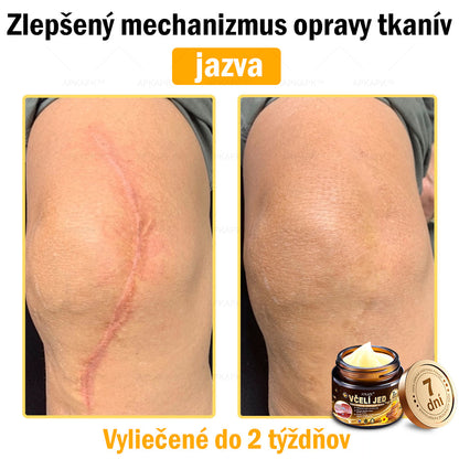 𝐀𝐏𝐊𝐀𝐏𝐊™ 𝐕č𝐞𝐥í 𝐉𝐞𝐝 𝐊𝐫é𝐦 𝐍𝐚 𝐑𝐞𝐠𝐞𝐧𝐞𝐫á𝐜𝐢𝐮 𝐏𝐥𝐞𝐭𝐢 🧑‍⚕️𝐎š𝐞𝐭𝐫𝐞𝐧𝐢𝐞 𝐤𝐨ž𝐧ý𝐜𝐡 𝐩𝐫𝐨𝐛𝐥é𝐦𝐨𝐯 𝐳𝐚𝐡ŕň𝐚: 𝐯𝐞𝐤𝐨𝐯é š𝐤𝐯𝐫𝐧𝐲, 𝐣𝐚𝐳𝐯𝐲, 𝐛𝐫𝐚𝐝𝐚𝐯𝐢𝐜𝐞, 𝐤𝐨ž𝐧é 𝐯ý𝐫𝐚𝐬𝐭𝐤𝐲, 𝐟𝐮𝐫𝐮𝐧𝐤𝐥𝐲, 𝐚𝐤𝐧é, 𝐞𝐤𝐳é𝐦𝐲, 𝐩𝐬𝐨𝐫𝐢á𝐳𝐮, 𝐚𝐤𝐧é 𝐢𝐧𝐯𝐞𝐫𝐬𝐚, 𝐯𝐫á𝐬𝐤𝐲, 𝐬𝐭𝐚𝐫𝐧𝐮𝐭𝐢𝐞 𝐩𝐥𝐞𝐭𝐢 𝐚 ď𝐚𝐥š𝐢𝐞.🔥🔥🔥