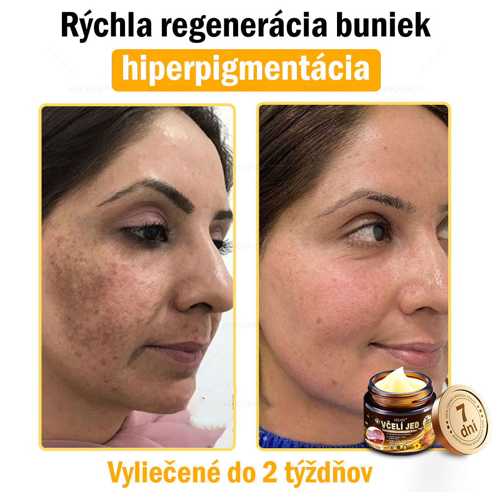 𝐀𝐏𝐊𝐀𝐏𝐊™ 𝐕č𝐞𝐥í 𝐉𝐞𝐝 𝐊𝐫é𝐦 𝐍𝐚 𝐑𝐞𝐠𝐞𝐧𝐞𝐫á𝐜𝐢𝐮 𝐏𝐥𝐞𝐭𝐢 🧑‍⚕️𝐎š𝐞𝐭𝐫𝐞𝐧𝐢𝐞 𝐤𝐨ž𝐧ý𝐜𝐡 𝐩𝐫𝐨𝐛𝐥é𝐦𝐨𝐯 𝐳𝐚𝐡ŕň𝐚: 𝐯𝐞𝐤𝐨𝐯é š𝐤𝐯𝐫𝐧𝐲, 𝐣𝐚𝐳𝐯𝐲, 𝐛𝐫𝐚𝐝𝐚𝐯𝐢𝐜𝐞, 𝐤𝐨ž𝐧é 𝐯ý𝐫𝐚𝐬𝐭𝐤𝐲, 𝐟𝐮𝐫𝐮𝐧𝐤𝐥𝐲, 𝐚𝐤𝐧é, 𝐞𝐤𝐳é𝐦𝐲, 𝐩𝐬𝐨𝐫𝐢á𝐳𝐮, 𝐚𝐤𝐧é 𝐢𝐧𝐯𝐞𝐫𝐬𝐚, 𝐯𝐫á𝐬𝐤𝐲, 𝐬𝐭𝐚𝐫𝐧𝐮𝐭𝐢𝐞 𝐩𝐥𝐞𝐭𝐢 𝐚 ď𝐚𝐥š𝐢𝐞.🔥🔥🔥