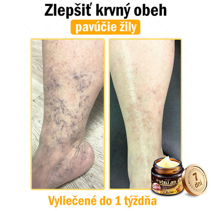 𝐀𝐏𝐊𝐀𝐏𝐊™ 𝐕č𝐞𝐥í 𝐉𝐞𝐝 𝐊𝐫é𝐦 𝐍𝐚 𝐑𝐞𝐠𝐞𝐧𝐞𝐫á𝐜𝐢𝐮 𝐏𝐥𝐞𝐭𝐢 🧑‍⚕️𝐎š𝐞𝐭𝐫𝐞𝐧𝐢𝐞 𝐤𝐨ž𝐧ý𝐜𝐡 𝐩𝐫𝐨𝐛𝐥é𝐦𝐨𝐯 𝐳𝐚𝐡ŕň𝐚: 𝐯𝐞𝐤𝐨𝐯é š𝐤𝐯𝐫𝐧𝐲, 𝐣𝐚𝐳𝐯𝐲, 𝐛𝐫𝐚𝐝𝐚𝐯𝐢𝐜𝐞, 𝐤𝐨ž𝐧é 𝐯ý𝐫𝐚𝐬𝐭𝐤𝐲, 𝐟𝐮𝐫𝐮𝐧𝐤𝐥𝐲, 𝐚𝐤𝐧é, 𝐞𝐤𝐳é𝐦𝐲, 𝐩𝐬𝐨𝐫𝐢á𝐳𝐮, 𝐚𝐤𝐧é 𝐢𝐧𝐯𝐞𝐫𝐬𝐚, 𝐯𝐫á𝐬𝐤𝐲, 𝐬𝐭𝐚𝐫𝐧𝐮𝐭𝐢𝐞 𝐩𝐥𝐞𝐭𝐢 𝐚 ď𝐚𝐥š𝐢𝐞.🔥🔥🔥