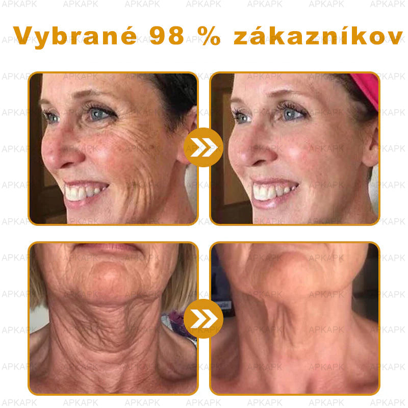 𝐀𝐏𝐊𝐀𝐏𝐊™ 𝐕č𝐞𝐥í 𝐉𝐞𝐝 𝐊𝐫é𝐦 𝐍𝐚 𝐑𝐞𝐠𝐞𝐧𝐞𝐫á𝐜𝐢𝐮 𝐏𝐥𝐞𝐭𝐢 🧑‍⚕️𝐎š𝐞𝐭𝐫𝐞𝐧𝐢𝐞 𝐤𝐨ž𝐧ý𝐜𝐡 𝐩𝐫𝐨𝐛𝐥é𝐦𝐨𝐯 𝐳𝐚𝐡ŕň𝐚: 𝐯𝐞𝐤𝐨𝐯é š𝐤𝐯𝐫𝐧𝐲, 𝐣𝐚𝐳𝐯𝐲, 𝐛𝐫𝐚𝐝𝐚𝐯𝐢𝐜𝐞, 𝐤𝐨ž𝐧é 𝐯ý𝐫𝐚𝐬𝐭𝐤𝐲, 𝐟𝐮𝐫𝐮𝐧𝐤𝐥𝐲, 𝐚𝐤𝐧é, 𝐞𝐤𝐳é𝐦𝐲, 𝐩𝐬𝐨𝐫𝐢á𝐳𝐮, 𝐚𝐤𝐧é 𝐢𝐧𝐯𝐞𝐫𝐬𝐚, 𝐯𝐫á𝐬𝐤𝐲, 𝐬𝐭𝐚𝐫𝐧𝐮𝐭𝐢𝐞 𝐩𝐥𝐞𝐭𝐢 𝐚 ď𝐚𝐥š𝐢𝐞.🔥🔥🔥