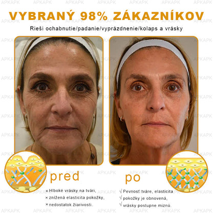 𝐀𝐏𝐊𝐀𝐏𝐊™ 𝐕č𝐞𝐥í 𝐉𝐞𝐝 𝐊𝐫é𝐦 𝐍𝐚 𝐑𝐞𝐠𝐞𝐧𝐞𝐫á𝐜𝐢𝐮 𝐏𝐥𝐞𝐭𝐢 🧑‍⚕️𝐎š𝐞𝐭𝐫𝐞𝐧𝐢𝐞 𝐤𝐨ž𝐧ý𝐜𝐡 𝐩𝐫𝐨𝐛𝐥é𝐦𝐨𝐯 𝐳𝐚𝐡ŕň𝐚: 𝐯𝐞𝐤𝐨𝐯é š𝐤𝐯𝐫𝐧𝐲, 𝐣𝐚𝐳𝐯𝐲, 𝐛𝐫𝐚𝐝𝐚𝐯𝐢𝐜𝐞, 𝐤𝐨ž𝐧é 𝐯ý𝐫𝐚𝐬𝐭𝐤𝐲, 𝐟𝐮𝐫𝐮𝐧𝐤𝐥𝐲, 𝐚𝐤𝐧é, 𝐞𝐤𝐳é𝐦𝐲, 𝐩𝐬𝐨𝐫𝐢á𝐳𝐮, 𝐚𝐤𝐧é 𝐢𝐧𝐯𝐞𝐫𝐬𝐚, 𝐯𝐫á𝐬𝐤𝐲, 𝐬𝐭𝐚𝐫𝐧𝐮𝐭𝐢𝐞 𝐩𝐥𝐞𝐭𝐢 𝐚 ď𝐚𝐥š𝐢𝐞.🔥🔥🔥
